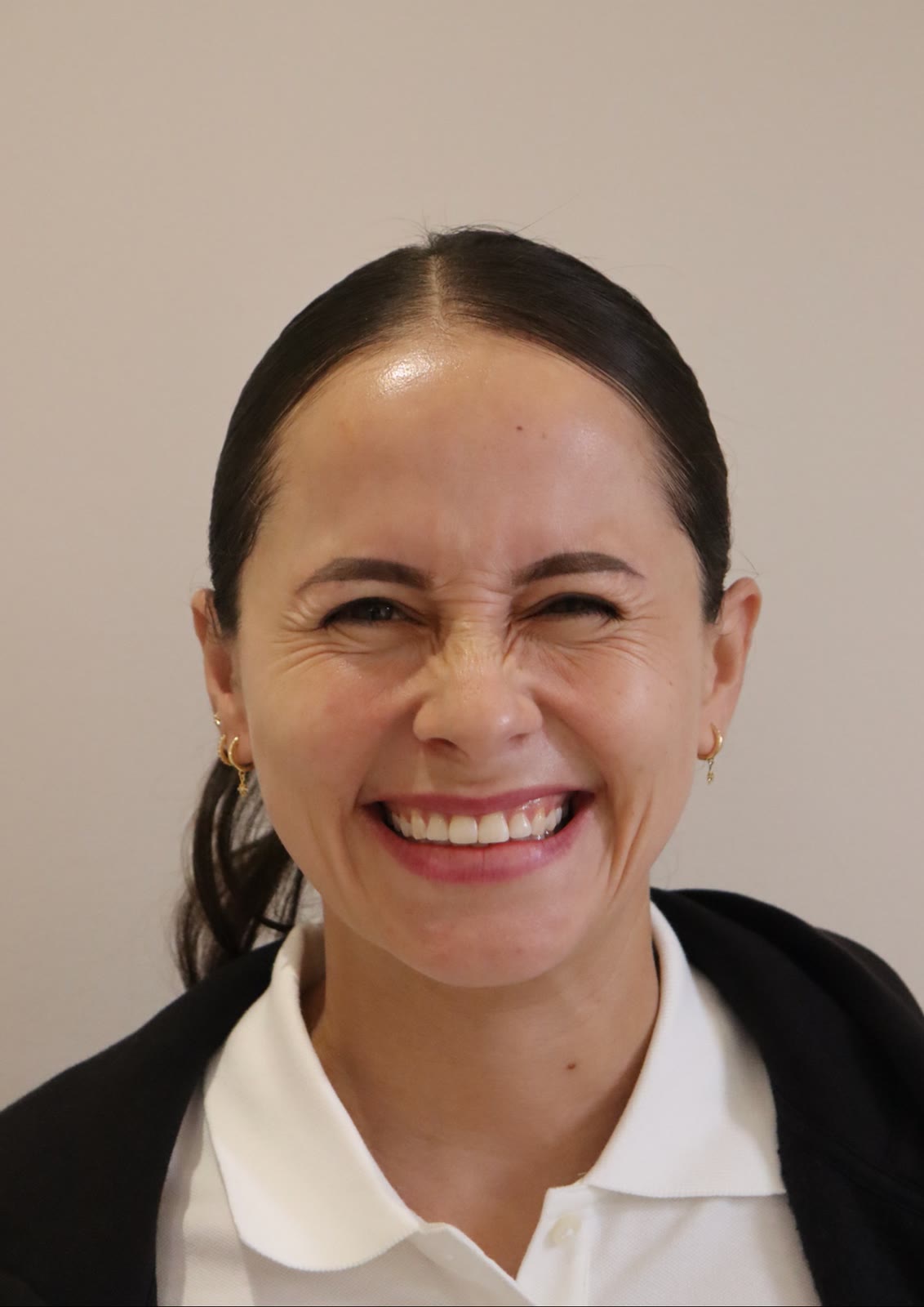 Antes de toxina botulínica, paciente de la Dra. Brenda López